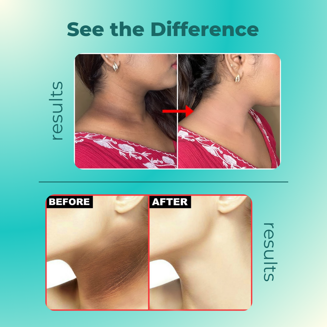 Dark Neck & Elbow Whitening Cream